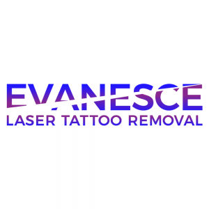 evanesce laser tattoo removal national tattoo removal day