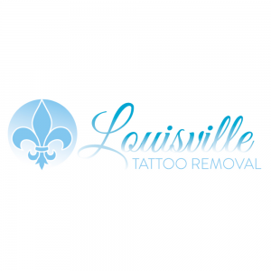 louiseville tattoo removal national tattoo removal day