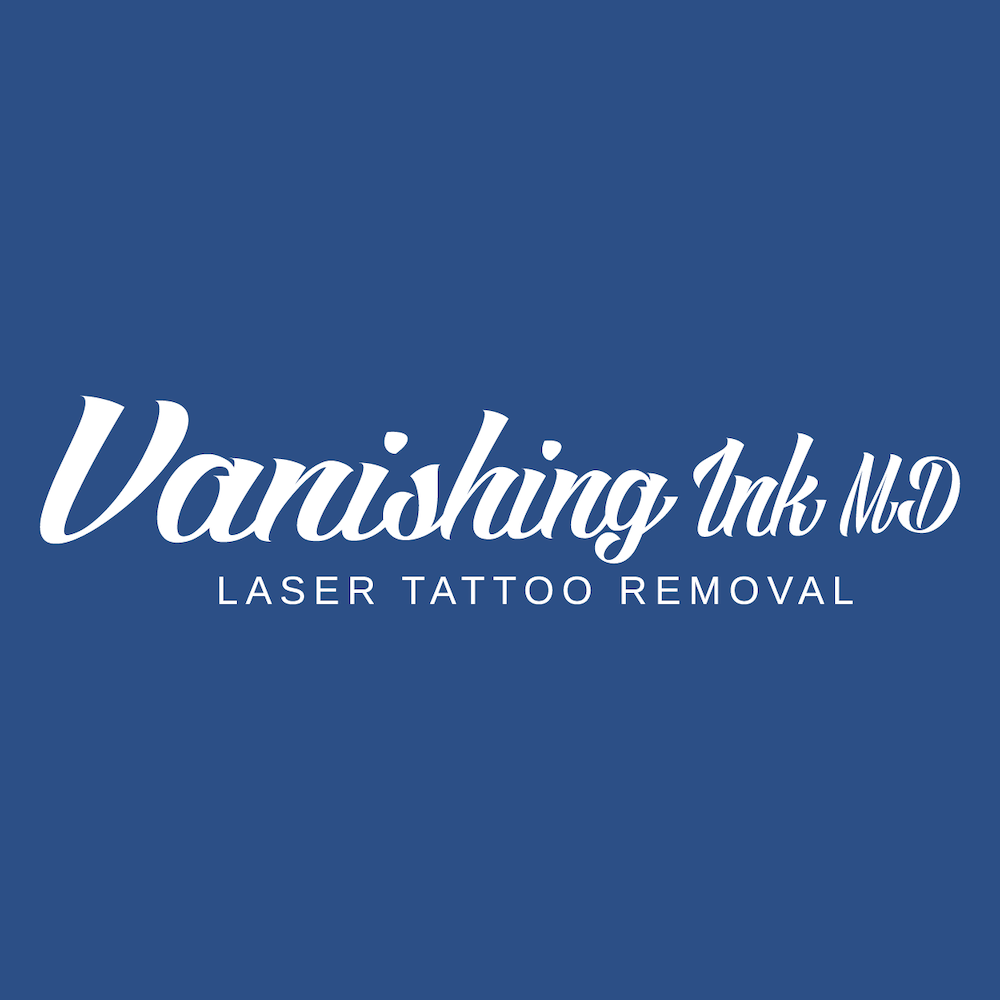 vanishing ink conroe texas tattoo removal national tattoo removal day