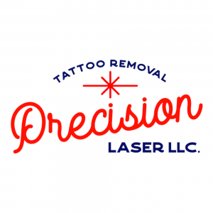precision laser tattoo removal easton pa